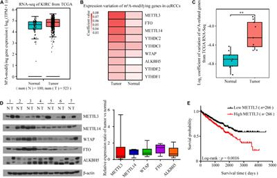 The RNA N6-Methyladenosine Methyltransferase METTL3 Promotes the Progression of Kidney Cancer via N6-Methyladenosine-Dependent Translational Enhancement of ABCD1